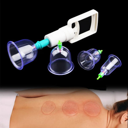 6-Piece Vacuum Cupping Therapy Set