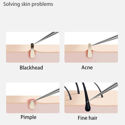 Clear Skin Essentials: Stainless Steel Acne & Blackhead Removal Kit