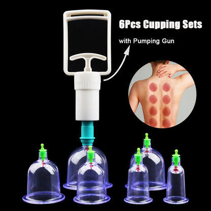 6-Piece Vacuum Cupping Therapy Set