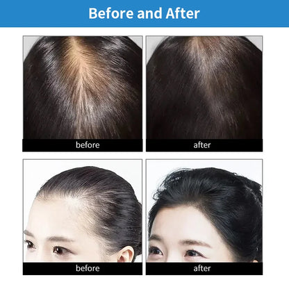 LED Hair Growth Cap – 660nm + 830nm